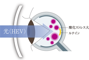 一般的なレンズを装用した